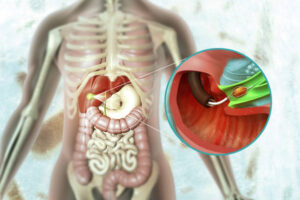 Biliary Tract and Liver Surgery in Dubai for Fast Relief 1 Biliary Tract and Liver Surgery in Dubai for Fast Relief