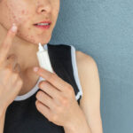 Acne Treatment in Noida, India & Skin Doctor Near Me is offered by Dr. Roshni Saraf dermatological treatments