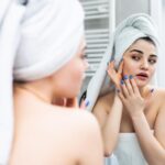 6 Signs You May Need Acne Scar Treatment Toronto 3 6 Signs You May Need Acne Scar Treatment Toronto