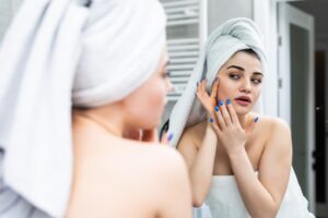 6 Signs You May Need Acne Scar Treatment Toronto