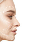 Vampire Facelift in Dubai: Cost, Benefits & Recovery