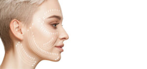 Vampire Facelift in Dubai: Cost, Benefits & Recovery 1 Vampire Facelift in Dubai: Cost, Benefits & Recovery
