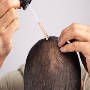 Hair Loss Treatment in Riyadh: Techniques to Boost Natural Hair Regrowth