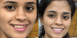 Top Rated Dental Clinic in Andheri Mumbai 1 Top Rated Dental Clinic in Andheri Mumbai