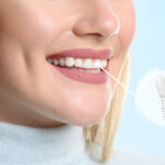 From Teeth Cleaning to Dental Implants: Understanding Your Dental Treatment Options 3 From Teeth Cleaning to Dental Implants: Understanding Your Dental Treatment Options