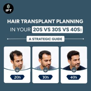 Hair Transplant Planning in Your 20s vs 30s vs 40s: A Strategic Guide