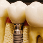 Where Can I Get a Dental Check-Up Near Grosse Pointe Park? A Complete Guide to Choosing the Right Dentist 3 Where Can I Get a Dental Check-Up Near Grosse Pointe Park? A Complete Guide to Choosing the Right Dentist