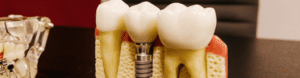 Where Can I Get a Dental Check-Up Near Grosse Pointe Park? A Complete Guide to Choosing the Right Dentist 1 Where Can I Get a Dental Check-Up Near Grosse Pointe Park? A Complete Guide to Choosing the Right Dentist