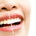 How Professional Teeth Whitening Is Planned for Natural Results 3 How Professional Teeth Whitening Is Planned for Natural Results