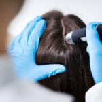 Why Exosome Hair in Dubai Is Ideal for Hair Restoration 3 Why Exosome Hair in Dubai Is Ideal for Hair Restoration
