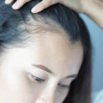 Transform Your Appearance with DHI Direct Hair Implant in Riyadh