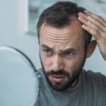 Hair Transplant for Fine Hair: Creating the Illusion of Greater Density 3 Hair Transplant for Fine Hair: Creating the Illusion of Greater Density