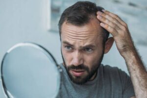 Hair Transplant for Fine Hair: Creating the Illusion of Greater Density 1 Hair Transplant for Fine Hair: Creating the Illusion of Greater Density