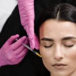 Cheek Augmentation in Dubai 18