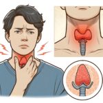 What Happens If Thyroid Swelling Is Left Untreated?