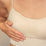 Exploring Breast Reduction in Riyadh for Comfortable Body Transformation