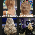 Womens Hair Loss Seattle Restore Confidence Naturally 3 Womens Hair Loss Seattle Restore Confidence Naturally