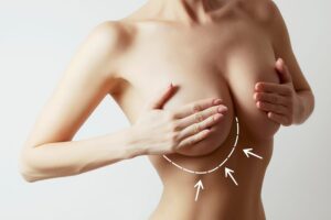 Choosing a Breast Surgery Clinic for Beautiful, Balanced Results