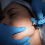 How Vector Facelift in Dubai Creates a Natural Facial Lift