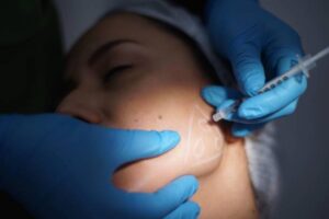 How Vector Facelift in Dubai Creates a Natural Facial Lift