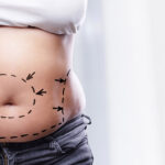Reclaiming Your Pre-Baby Body: Safe & Advanced Care at Mommy Makeover Lounge 3 Reclaiming Your Pre-Baby Body: Safe & Advanced Care at Mommy Makeover Lounge