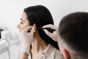 Top Questions About Ear Reshaping | Otoplasty Dubai
