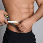 Vaser Quad Liposuction in Dubai 13