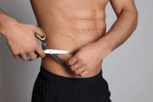 Why Vaser Quad Liposuction in Dubai Is So Popular