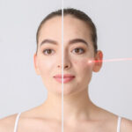 How to Get Rid of Back Acne With Advanced Treatment Options