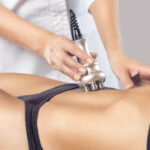 How Venus Legacy Treatment Helps Tighten Loose Skin Naturally