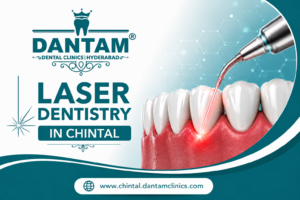 Laser Dentistry in Chintal: A Modern Approach to Comfortable Dental Care