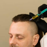 How Long Does It Take to See Results from PRP Hair Treatment?