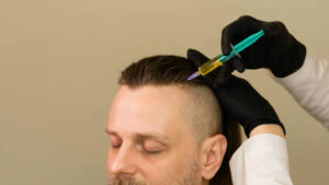 How Long Does It Take to See Results from PRP Hair Treatment?