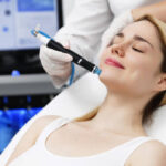 Hydrafacial Vs Chemical Peels: Choosing The Right Option For Your Skin 3 Hydrafacial Vs Chemical Peels: Choosing The Right Option For Your Skin