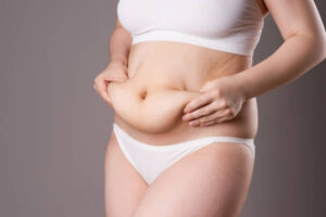 Tummy Tuck Surgery for Men: Benefits and Expectations
