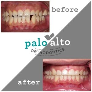 Exploring Modern Treatment Options for Healthier, Straighter Smiles 1 Exploring Modern Treatment Options for Healthier, Straighter Smiles