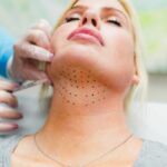 Innovative Double Chin Removal in Dubai Approaches
