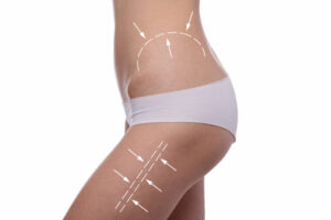 Body Contouring Treatment and Skin Tightening Benefits