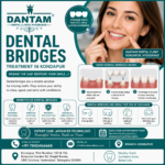 Dental Bridges Treatment in Kondapur for Restoring Missing Teeth and a Healthy Smile