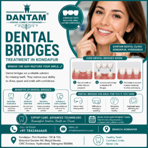 Dental Bridges Treatment in Kondapur for Restoring Missing Teeth and a Healthy Smile