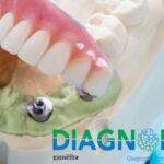 Leading Dental Clinic in Mumbai for Complete Oral Health Solutions 3 Leading Dental Clinic in Mumbai for Complete Oral Health Solutions