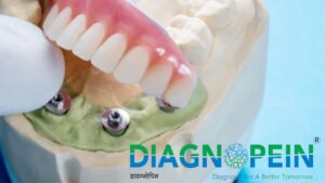 Leading Dental Clinic in Mumbai for Complete Oral Health Solutions