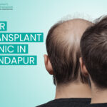 A Simple Guide to Hair Transplant Options in Kondapur, Hyderabad