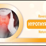 Reverse Hypothyroidism Naturally? 3 Reverse Hypothyroidism Naturally?