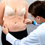 Tummy Tuck Results: What Real Dubai Patients Experienced