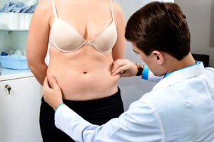 Tummy Tuck Results: What Real Dubai Patients Experienced