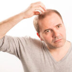 Stem Cell Hair Transplant: Contraindications and Precautions 3 Stem Cell Hair Transplant: Contraindications and Precautions