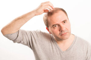 Stem Cell Hair Transplant: Contraindications and Precautions