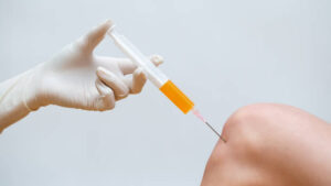 PRP Knee Injections in Dubai for Joint Regeneration