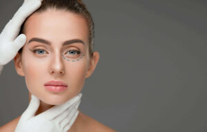 Eyelid Surgery: 10 Important Facts to Know About It 1 Eyelid Surgery: 10 Important Facts to Know About It